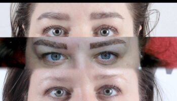 micro brow implant nedir JEsDbZyM