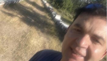 estetik cerrahin aricilik tutkusu L5HgEHrF
